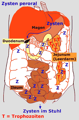 histologie duodenum giardiasis